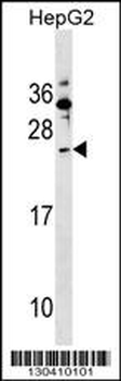 SHISA5 Antibody (Center)
