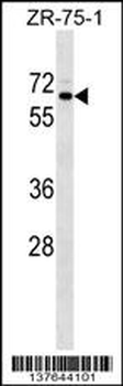 SRPR Antibody (C-term)