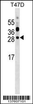 PRTFDC1 Antibody (C-term)