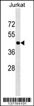 HOXC10 Antibody (Center)