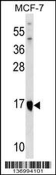 ITGB1BP1 Antibody (Center)