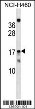 MRPS11 Antibody (Center)
