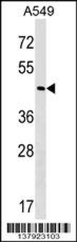 GABPB2 Antibody (Center)