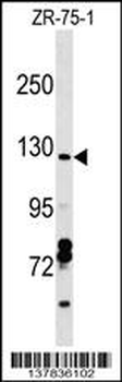 CCDC132 Antibody (C-term)