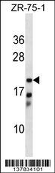 CBR4 Antibody (C-term)