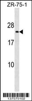 TMED3 Antibody (C-term)
