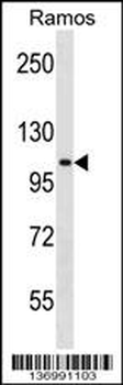 TACC1 Antibody (N-term)