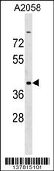 ADAT3 Antibody (N-term)