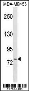 POMT2 Antibody (C-term)