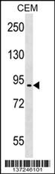 EPB41L4A Antibody (C-term)