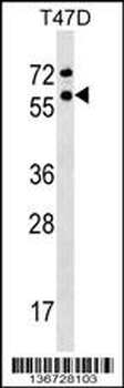 GTF2F1 Antibody (Center)