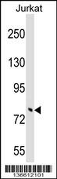 TRIM46 Antibody (N-term)