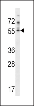PDE7A Antibody (N-term)