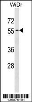 APG4D Antibody (Center S341)