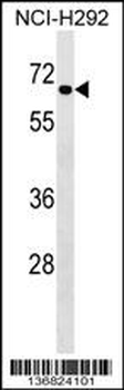 DYRK4 Antibody (Center)