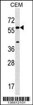 CYP21A2 Antibody (Center)