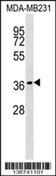 HEYL Antibody (N-term)