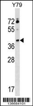 KLHDC8B Antibody (C-term)