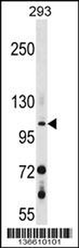 GUCY2F Antibody (C-term)