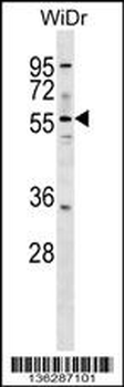 ASNS Antibody (N-term)