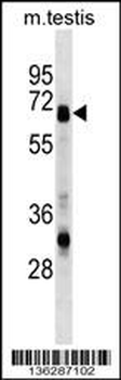 ASNS Antibody (N-term)