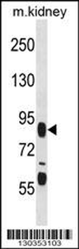 FIGN Antibody (C-term)