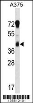 RCN1 Antibody (C-term)