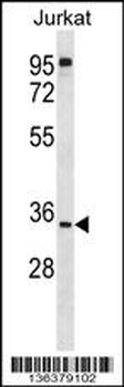 UBXN8 Antibody (N-term)