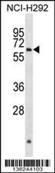 ARX Antibody (N-term)