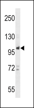 PTPN22 Antibody (C-term)