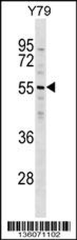 ZNF620 Antibody (N-term)