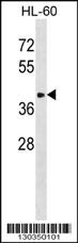 ST8SIA6 Antibody (Center)