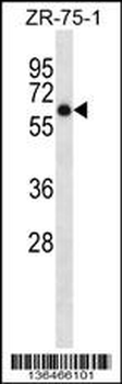 ARSD Antibody (C-term)