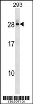 DCTD Antibody (N-term)