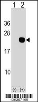 DCTD Antibody (N-term)
