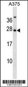 RPAIN Antibody (N-term)