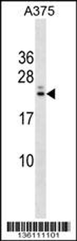 RYBP Antibody (N-term)