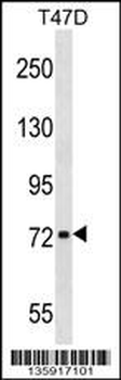 CHADL Antibody (Center)