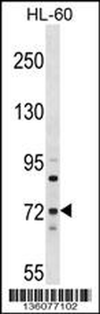 MTMR6 Antibody (N-term)