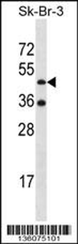 ETNK2 Antibody (N-term)