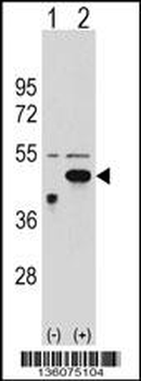 ETNK2 Antibody (N-term)