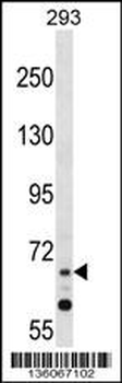 ZNF214 Antibody (N-term)