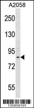ADAM23 Antibody (C-term)