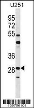 FOSL2 Antibody (C-term)