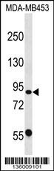 CAPN13 Antibody (C-term)