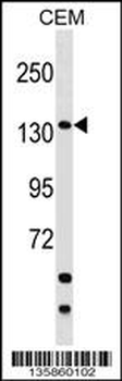 SAFB2 Antibody (Center)