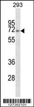 FBXO46 Antibody (C-term)