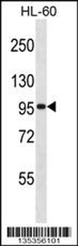 GTF3C2 Antibody (N-term)