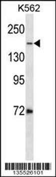 TOP2A Antibody (C-term)