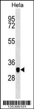 CAPG Antibody (Center)